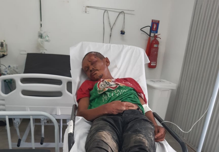 Portal Agreste Violento HOMEM MORRE APÓS SER BRUTALMENTE ESPANCADO EM